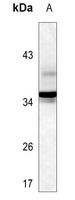 Anti-TorsinA Antibody