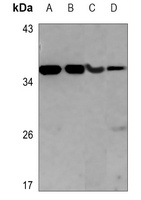 Anti-Pyridoxal Kinase Antibody