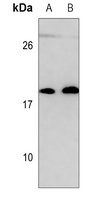 Anti-UBE2C Antibody