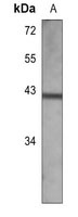 Anti-SULT2B1 Antibody