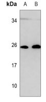 RAB27B antibody