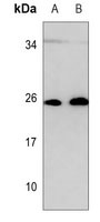 Anti-RAB27B Antibody