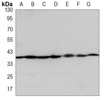 Anti-Annexin A1 Antibody
