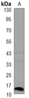 Histone H2A.X (phospho-S139) antibody