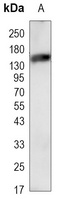 Anti-CD133 Antibody