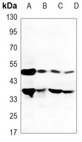 Anti-DR5 Antibody