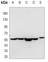 Anti-Pyruvate Kinase Antibody