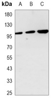 Anti-Hexokinase 2 Antibody
