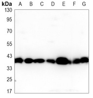 Anti-SIRT6 Antibody