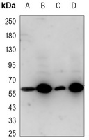 Metadherin antibody