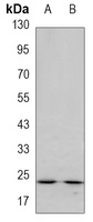 Anti-GSTP1 Antibody