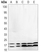 nm23-H1 antibody