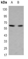 GAD2 antibody