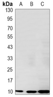 S100-A6 antibody