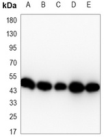 Alpha-enolase antibody