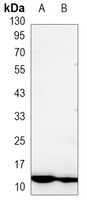Anti-S100-A4 Antibody