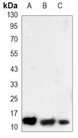 Anti-S100-A10 Antibody