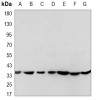 Anti-EIF2S1 Antibody