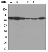 Anti-DDX3X Antibody