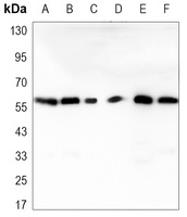 Anti-RAD23B Antibody