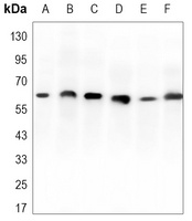 Anti-RPA1 Antibody