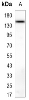 Anti-CD133 Antibody
