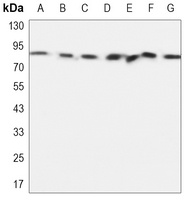 Anti-PI3K p85 beta Antibody