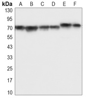 Anti-IGF2BP3 Antibody