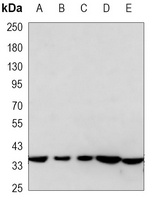 Anti-AMPK beta 1 Antibody