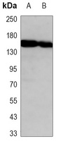 Histone Deacetylase 6 antibody
