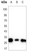Anti-CBR1 Antibody