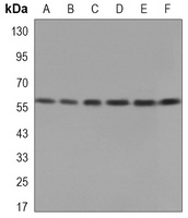 PDC-E2 antibody