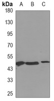 Anti-CALU Antibody