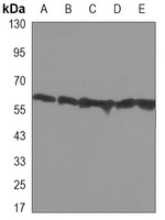 Anti-Pyruvate Kinase Antibody