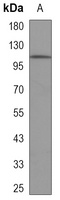 FYB antibody