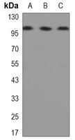 Hexokinase 2 antibody