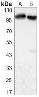 Anti-TIF1 beta Antibody