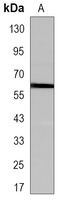 Anti-SMYD1 Antibody