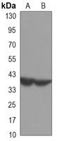 Anti-PRMT6 Antibody