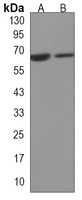 JMJD6 antibody