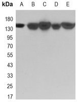 KDM4A antibody