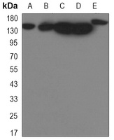 Anti-YTHDC2 Antibody