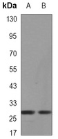 Anti-XBP1 Antibody