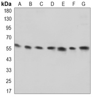 Anti-Visfatin Antibody