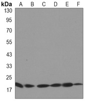 UBC9 antibody