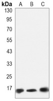 SOD1 antibody