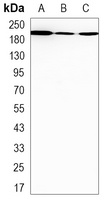 Anti-BRM Antibody