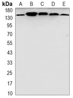 Anti-SAP155 Antibody