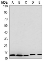 Anti-RPS20 Antibody