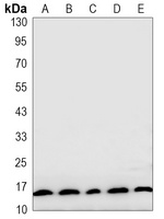 LC3-I/II antibody